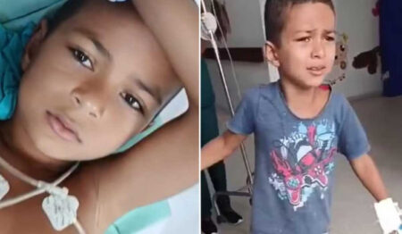 Criança tocantinense sobrevive após ser picado por jararaca e ficar 11 dias internado por reação ao soro antiofídico